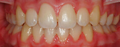 Before & Afters